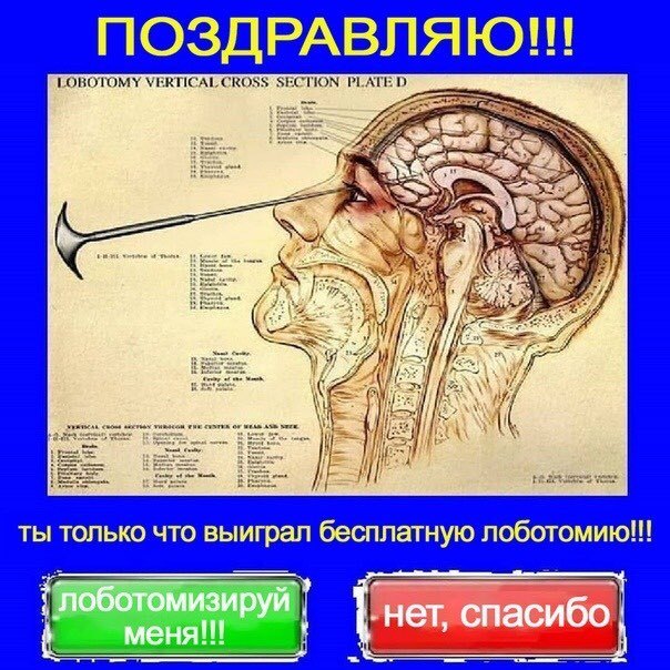 a meme in Russian, mimicking a sketchy website AD. the top line translates to "CONGRATULATIONS!!!" followed by a picture of a lobotomy procedure. under that is the text "you have won a free lobotomy!!!" and two buttons with "lobotomize me!!!" and "no, thank you" on them.