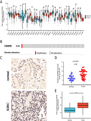CEBPB as a potential biomarker for prognosis and immuneinfiltration in clear cell renal cell carcinoma