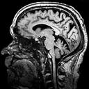 7T MRI clinical image of the head 