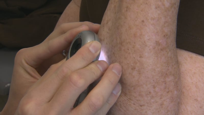 Free skin cancer screening in Colorado Springs today