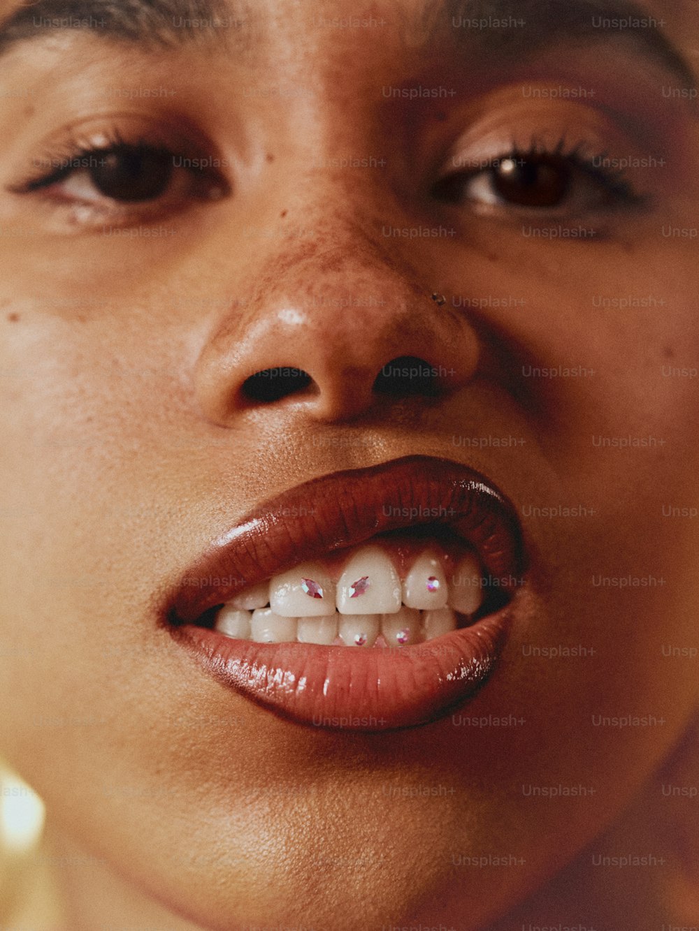 a close up of a woman's mouth with braces