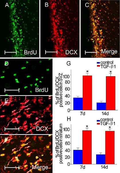 File:BrdU and DCX expression in adult mouse brain after tgf-beta1 and stroke.jpg