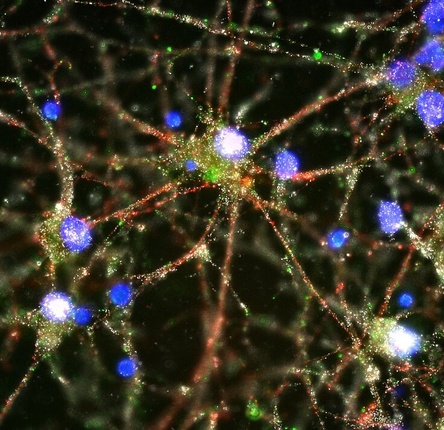 This image shows human neurons (in blue), with the C4 protein (in green) deposited on synapses. 